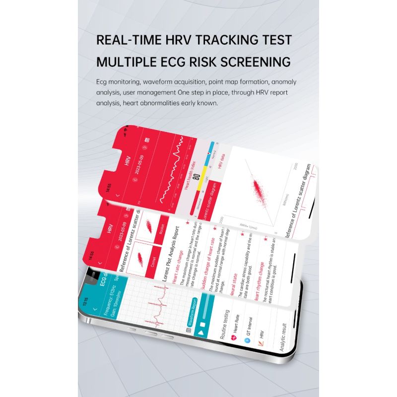 ET540 Blood glucose ECG Body temperature Blood pressure Blood oxygen Heart rate Bluetooth call Smartwatch Fitness Tracker